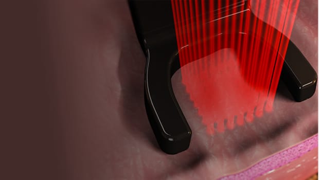 Bioestimulación y láser: la ciencia detrás de Harmony Bio-Boost